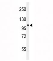 Western blot analysis of EphA2 antibody and mouse NIH3T3 lysate. Expected molecular weight: 108~130 kDa.