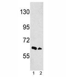 Western blot analysis of EphA3 antibody and 1) NCI-H460, 2) 293 lysate. Predicted molecular weight: 110/61 kDa (isoforms 1/2).~