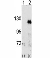 Western blot analysis of EphA3 antibody and 293 cell lysate either nontransfected (Lane 1) or transiently transfected with the EphA3 gene (2). Predicted molecular weight: 110/61 kDa (isoforms 1/2).