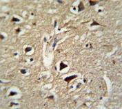 IHC analysis of FFPE human brain tissue stained with PCSK2 antibody