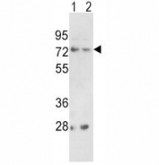 Western blot analysis of PCSK2 antibody and (1) 293 and (2) K562 lysate