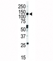 Western blot analysis of EphB2 antibody and NCI-H460 cell lysate.