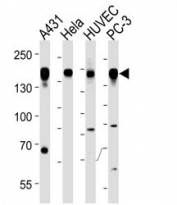 Epidermal Growth Factor Receptor antibody western blot analysis in A431, HeLa, HUVEC, PC3 lysate. Expected molecular weight: ~134/170 kDa (unmodified/glycosylated).