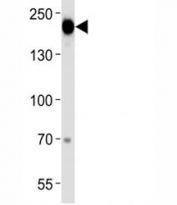 Epidermal Growth Factor Receptor antibody western blot analysis in A431 lysate. Expected molecular weight: ~134/170 kDa (unmodified/glycosylated).