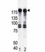 Western blot analysis of EGF Receptor antibody and HeLa cell lysate, either induced (Lane 1) or noninduced with EGF (2). Expected molecular weight: ~134/170 kDa (unmodified/glycosylated).