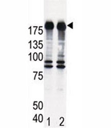 Western blot analysis of EGF Receptor antibody and HeLa cell lysate, either induced (Lane 1) or noninduced with EGF (2).