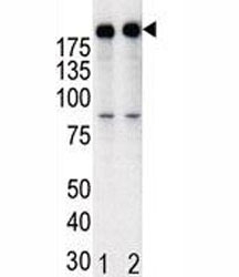 Western blot analysis of anti-HER2 in T47D cell lysate, either noninduced (Lane 1) or induced with HRG (2).