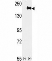 Western blot analysis of anti-HER2 antibody and 293 cell lysate (2 ug/lane) either nontransfected (Lane 1) or transiently transfected with the ERBB2 gene (2).