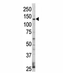 Western blot analysis of ErbB4 / HER4 antibody and HL-60 cell lysate. Predicted molecular weight: 147-180 kDa (precursor), 120, 80 kDa (cleaved forms).~