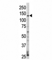 Western blot analysis of ErbB4 / HER4 antibody and HL-60 cell lysate. Predicted molecular weight: 147-180 kDa (precursor), 120, 80 kDa (cleaved forms).