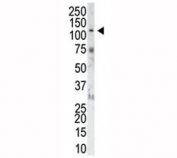 The FGFR1 antibody used in western blot to detect FGFR1 in NIH3T3 cell lysate. Predicted molecular weight: 75-160 kDa depending on glycosylation level.