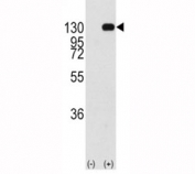 Western blot analysis of FGFR antibody and 293 cell lysate (2 ug/lane) either nontransfected (Lane 1) or transiently transfected with the FGFR1 gene (2). Predicted molecular weight: 75-160 kDa depending on glycosylation level.