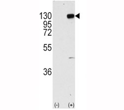 Western blot analysis of FGFR1 antibody and 293 cell lysate (2 ug/lane) either nontransfected (Lane 1) or transiently transfected with the FGFR1 gene (2). Predicted molecular weight: 75-160 kDa depending on glycosylation level.