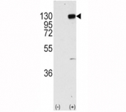 Western blot analysis of FGFR1 antibody and 293 cell lysate (2 ug/lane) either nontransfected (Lane 1) or transiently transfected with the FGFR1 gene (2). Predicted molecular weight: 75-160 kDa depending on glycosylation level.