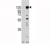 Western blot analysis of FGF receptor antibody and 293 cell lysate (2 ug/lane) either nontransfected (Lane 1) or transiently transfected with the FGFR1 gene (2). Predicted molecular weight: 75-160 kDa depending on glycosylation level.
