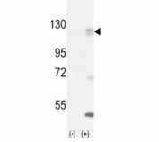 Western blot analysis of FGFR antibody and 293 cell lysate (2 ug/lane) either nontransfected (Lane 1) or transiently transfected with the FGFR1 gene (2).