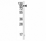 Western blot analysis of FGFR antibody and K562 lysate. Predicted molecular weight: 75-160 kDa depending on glycosylation level.