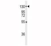 Western blot analysis of FGFR1 antibody and mouse liver tissue lysate. Predicted molecular weight: 75-160 kDa depending on glycosylation level.