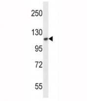 FGFR2 antibody western blot analysis in mouse NIH3T3 lysate. Predicted molecular weight: 80-120 kDa. The observed size may be larger due to glycosylation.