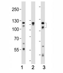 Western blot analysis of lysate from (1) HeLa, (2) K562 and (3) T47D cell line using FGFR2 antibody at 1:1000. Predicted molecular weight: 80-120 kDa.