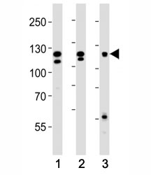 Western blot analysis of lysate from (1) HeLa, (2) K562 and (3) MCF-7 cell line using FGFR2 antibody at 1:1000. Predicted molecular weight: 80-120 kDa.