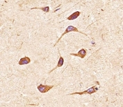 Immunohistochemical analysis of paraffin-embedded human brain section using FGFR2 antibody; Ab was diluted at 1:25 dilution.