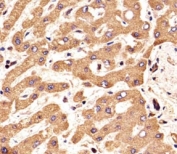 IHC analysis of FFPE human liver section using FGFR2 antibody; Ab was diluted at 1:25.