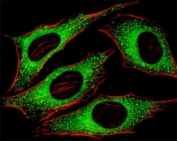 Fluorescent image of HeLa cells stained with FGFR2 antibody at 1:25 dilution. An Alexa Fluor 488-conjugated goat anti-rabbit lgG was used as the secondary Ab (green). Cytoplasmic actin was counterstained with Alexa Fluor 555 conjugated with Phalloidin (red).