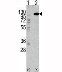 Western blot analysis of FGFR2 antibody and 293 lysate transiently transfected with the human gene. Predicted molecular weight: 80-120 kDa