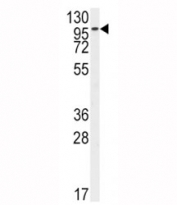 Western blot analysis of FGFR2 antibody and HeLa lysate. Predicted molecular weight: 80-120 kDa. The observed size may be larger due to glycosylation.
