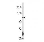 Western blot testing of human NCI-H460 cell lysate with FGFR2 antibody. Predicted molecular weight of multiple isoforms: 80-120 kDa. The observed size may be larger due to glycosylation.