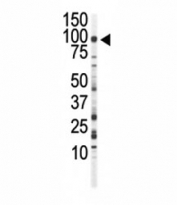 Western blot analysis of FGFR3 antibody and Jurkat cell lysate. Predicted molecular weight: 87-135 kDa depending on glycosylation level.