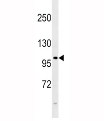 FGFR4 antibody western blot analysis in 293 lysate. Observed molecular weight: 88~125 kDa depending on phosphorylation and glycosylation level.