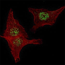 Fluorescent confocal image of HeLa cells stained with FGFR4 antibody. HeLa cells were fixed with 4% PFA (20 min), permeabilized with Triton X-100 (0.2%, 30 min). Cells were then incubated with primary Ab (1:200, 2 h at room temperature). For secondary Ab, Alexa Fluor 488 conjugated donkey anti-rabbit Ab (green) was used (1:1000, 1h). Nuclei were counterstained with Hoechst 33342 (blue) (10 ug/ml, 5 min). Note the highly specific localization of FGFR4 to the nucleus, supported by Human Protein Atlas Data (<a href=https://www.proteinatlas.org/ENSG00000160867)><a href=https://www.proteinatlas.org/ENSG00000160867><a href=https://www.proteinatlas.org/ENSG00000160867>https://www.proteinatlas.org/ENSG00000160867</a></a>).