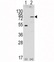 Western blot analysis of FGFR4 antibody and 293 cell lysate (2 ug/lane) either nontransfected (Lane 1) or transiently transfected with the FGFR4 gene (2).