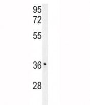 IGFBP3 western blot analysis in mouse stomach tissue lysate. The glycoprotein is visualized between 31~44 kDa.