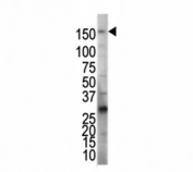 Western blot analysis of VEGFR2 antibody and HeLa cell lysate. Predicted molecular weight: ~152 (immature), 180-200 kDa (intermediate) and 220-230 kDa (mature).