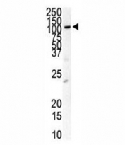 Western blot analysis of anti-FLT3 antibody and HL-60 cell lysate