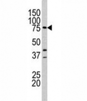 Western blot analysis of Lactoferrin antibody (1:60 dilution) and mouse heart tissue lysate. Predicted molecular weight: ~78/73kDa (isoforms 1/2).