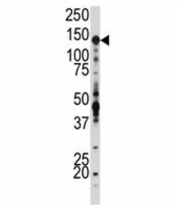 Western blot analysis of IGF1R antibody and SK-BR-3 lysate. Predicted molecular weight: ~200 kDa (pro), 120-130 kDa (alpha), 90-97 kDa (beta).