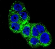 Confocal immunofluorescent analysis of IGF1R antibody with WiDr cells followed by Alexa Fluor 488-conjugated goat anti-rabbit lgG (green). DAPI was used as a nuclear counterstain (blue).