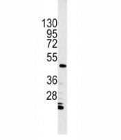 Western blot analysis of Integrin linked kinase antibody and HL-60 cell lysate. Expected molecular weight: 51-59 kDa.