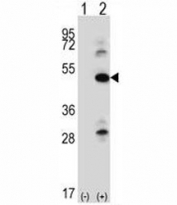 Western blot analysis of ILK antibody and 293 cell lysate either nontransfected (Lane 1) or transiently transfected (2) with the ILK gene. Expected molecular weight: 51-59 kDa.