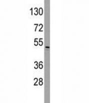 Western blot analysis of ILK antibody and HeLa lysate. Expected molecular weight: 51-59 kDa.