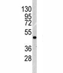 Western blot analysis of ILK1 antibody and NCI-H460 lysate. Expected molecular weight: 51-59 kDa.~