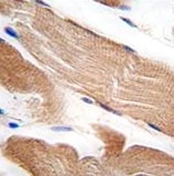 IHC analysis of FFPE human skeletal muscle tissue stained with ILK1 antibody