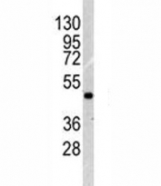 Western blot analysis of ILK1 antibody and NCI-H460 lysate. Expected molecular weight: 51-59 kDa.
