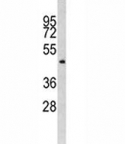 Western blot analysis of ILK antibody and MDA-MB435 lysate. Expected molecular weight: 51-59 kDa.