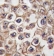 IHC analysis of FFPE human testis tissue stained with Insulin receptor-related antibody.