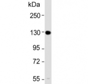 Western blot analysis of Insulin receptor-related antibody and mouse brain lysate. Expected molecular weight: ~80 kDa, 144 kDa.